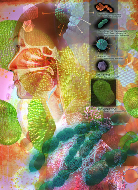 Editorial illustration of upper respiratory attackers. Influenza, Rhinovirus, Adenovirus, Staphylocuccus, Strephylocuccus